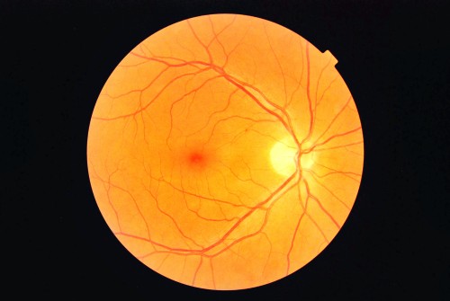 Retina